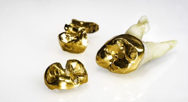 Goldkronen und Zahngold